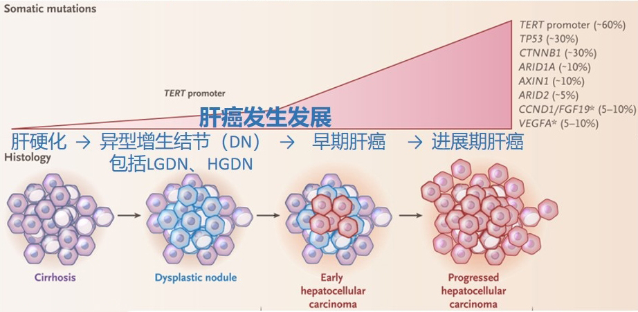 一管血 · 三种癌 | 肠胃肝消化三癌联检可有效降低高发癌发病率和死亡率