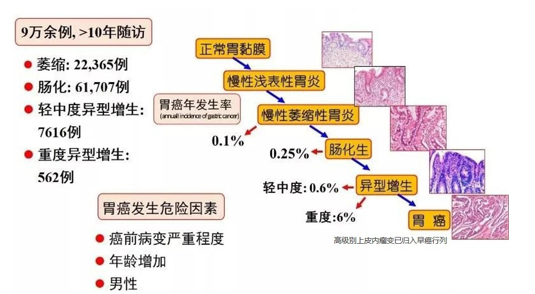 一管血 · 三种癌 | 肠胃肝消化三癌联检可有效降低高发癌发病率和死亡率